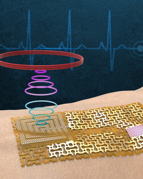 sensor 
