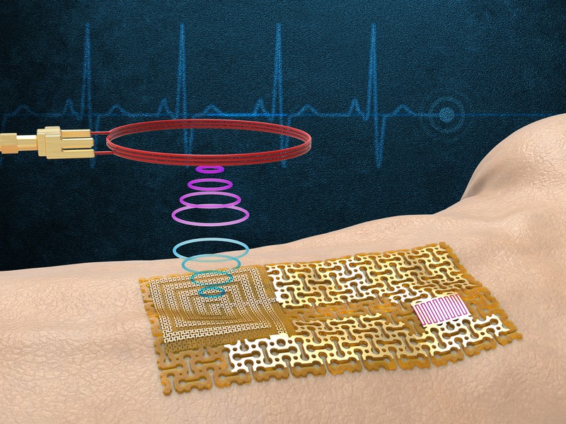 sensor 
